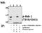 Ribosomal Protein S6 Kinase A1 antibody, A01058T359S363, Boster Biological Technology, Western Blot image 