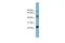 Myelin Protein Zero Like 1 antibody, A06667, Boster Biological Technology, Western Blot image 