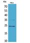 RAB5A, Member RAS Oncogene Family antibody, STJ96821, St John