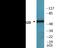 Calcium/Calmodulin Dependent Protein Kinase II Alpha antibody, EKC2366, Boster Biological Technology, Western Blot image 