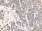 ASXL Transcriptional Regulator 2 antibody, PA5-68361, Invitrogen Antibodies, Immunohistochemistry paraffin image 