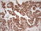 PYM Homolog 1, Exon Junction Complex Associated Factor antibody, LS-C790935, Lifespan Biosciences, Immunohistochemistry paraffin image 