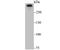 Huntingtin antibody, A00134-1, Boster Biological Technology, Western Blot image 