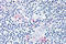 TOR antibody, SP4490P, Origene, Immunohistochemistry paraffin image 