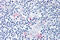 TOR antibody, SP4490P, Origene, Immunohistochemistry paraffin image 