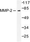 Matrix Metallopeptidase 2 antibody, LS-C176127, Lifespan Biosciences, Western Blot image 