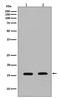 Calmodulin antibody, M06609, Boster Biological Technology, Western Blot image 