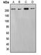 SWI/SNF Related, Matrix Associated, Actin Dependent Regulator Of Chromatin, Subfamily A, Member 2 antibody, LS-C352855, Lifespan Biosciences, Western Blot image 