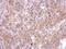 SPARC (Osteonectin), Cwcv And Kazal Like Domains Proteoglycan 3 antibody, GTX119149, GeneTex, Immunohistochemistry paraffin image 