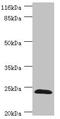 Glutathione S-Transferase Zeta 1 antibody, LS-C682119, Lifespan Biosciences, Western Blot image 