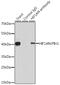 Hypoxia Inducible Factor 1 Subunit Alpha Inhibitor antibody, GTX32652, GeneTex, Immunoprecipitation image 