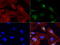 Interferon Regulatory Factor 6 antibody, LS-C799228, Lifespan Biosciences, Immunofluorescence image 