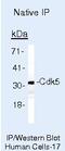 Cyclin Dependent Kinase 5 antibody, AHZ0492, Invitrogen Antibodies, Immunoprecipitation image 