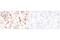 TNF Receptor Superfamily Member 4 antibody, 98785S, Cell Signaling Technology, Immunohistochemistry paraffin image 