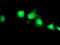 Eukaryotic Translation Initiation Factor 2B Subunit Gamma antibody, TA503562, Origene, Immunofluorescence image 