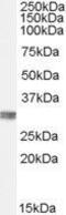 Chloride Intracellular Channel 4 antibody, GTX89013, GeneTex, Western Blot image 