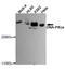 Protein Kinase, DNA-Activated, Catalytic Subunit antibody, STJ99135, St John