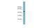 Ring Finger Protein 44 antibody, A16090, Boster Biological Technology, Western Blot image 