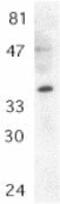 MYD88 Innate Immune Signal Transduction Adaptor antibody, ab2064, Abcam, Western Blot image 