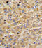 ADAMTS13 antibody, LS-C100639, Lifespan Biosciences, Immunohistochemistry frozen image 