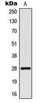 Thy-1 Cell Surface Antigen antibody, LS-C354130, Lifespan Biosciences, Western Blot image 