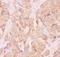 Angio Associated Migratory Cell Protein antibody, PB9123, Boster Biological Technology, Immunohistochemistry frozen image 