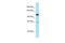 Structural Maintenance Of Chromosomes 6 antibody, A01554, Boster Biological Technology, Western Blot image 