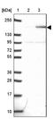 Tensin 3 antibody, NBP2-37952, Novus Biologicals, Western Blot image 