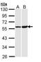 Opioid Receptor Kappa 1 antibody, GTX108164, GeneTex, Western Blot image 