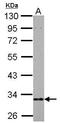 3-hydroxyisobutyrate dehydrogenase, mitochondrial antibody, GTX122994, GeneTex, Western Blot image 