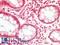 SWI/SNF Related, Matrix Associated, Actin Dependent Regulator Of Chromatin, Subfamily B, Member 1 antibody, LS-B12907, Lifespan Biosciences, Immunohistochemistry paraffin image 