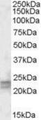 ADP Ribosylation Factor Like GTPase 4D antibody, PA5-19005, Invitrogen Antibodies, Western Blot image 