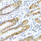 Leucine Rich Pentatricopeptide Repeat Containing antibody, 19-047, ProSci, Immunohistochemistry paraffin image 