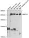 Bromodomain Adjacent To Zinc Finger Domain 1A antibody, A04090, Boster Biological Technology, Western Blot image 