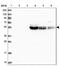 Solute Carrier Family 2 Member 11 antibody, NBP2-13326, Novus Biologicals, Western Blot image 