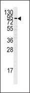 Plasminogen antibody, PA5-14196, Invitrogen Antibodies, Western Blot image 