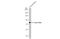 Coagulation factor XIII A chain antibody, GTX110434, GeneTex, Western Blot image 