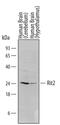 Ras Like Without CAAX 2 antibody, MA5-24177, Invitrogen Antibodies, Western Blot image 