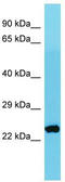 Mitochondrial Ribosomal Protein S26 antibody, TA330718, Origene, Western Blot image 