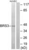 Bombesin Receptor Subtype 3 antibody, LS-C120556, Lifespan Biosciences, Western Blot image 