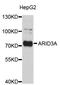 AT-Rich Interaction Domain 3A antibody, STJ22681, St John
