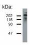 Neurofilament Heavy antibody, MA1-10441, Invitrogen Antibodies, Western Blot image 