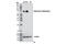 Dopamine Beta-Hydroxylase antibody, 8586S, Cell Signaling Technology, Western Blot image 