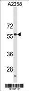 Ubiquitin Specific Peptidase 14 antibody, 60-770, ProSci, Western Blot image 
