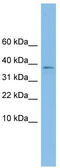 Kelch Domain Containing 9 antibody, TA339946, Origene, Western Blot image 