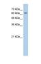 Solute Carrier Family 38 Member 1 antibody, NBP1-59650, Novus Biologicals, Western Blot image 