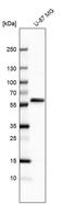 Cysteinyl-TRNA Synthetase 2, Mitochondrial antibody, PA5-59722, Invitrogen Antibodies, Western Blot image 