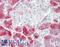 Serine Protease 3 antibody, LS-B11527, Lifespan Biosciences, Immunohistochemistry paraffin image 