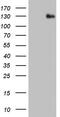 ADAM Metallopeptidase With Thrombospondin Type 1 Motif 1 antibody, M03009, Boster Biological Technology, Western Blot image 