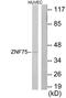 Zinc Finger Protein 75D antibody, TA314690, Origene, Western Blot image 